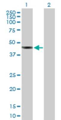 Western Blot: SDS3 Antibody [H00064426-B01P]