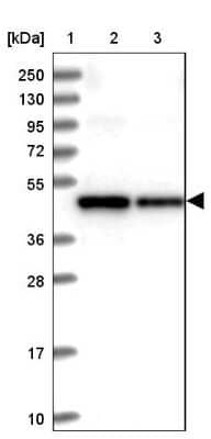 Western Blot: SDS3 Antibody [NBP2-48751]