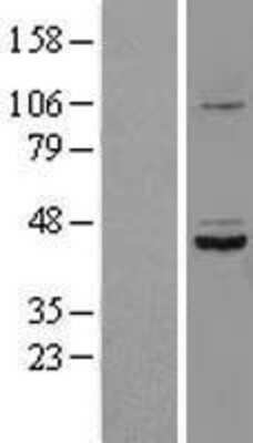 Western Blot: SDS3 Overexpression Lysate [NBL1-16596]