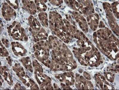 Immunohistochemistry: SDSL Antibody (OTI1A8) [NBP2-45978]