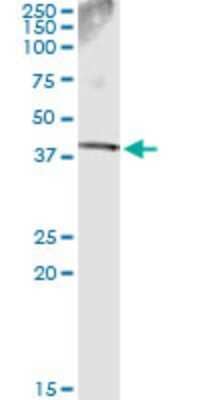 Immunoprecipitation: SDSL Antibody (2F8-6C9) [H00113675-M03]