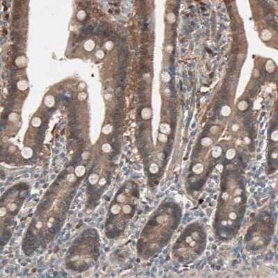 Immunohistochemistry-Paraffin: SDSL Antibody [NBP1-87058]