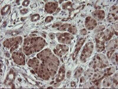Immunohistochemistry: SDSL Antibody (OTI1A8) - Azide and BSA Free [NBP2-74045]