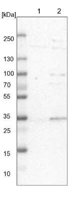 Western Blot: SDSL Antibody [NBP1-87058]