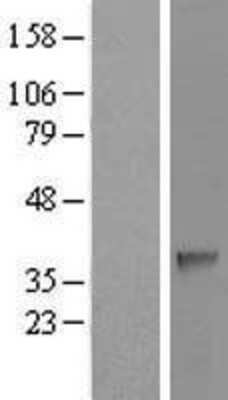 Western Blot: SDSL Overexpression Lysate [NBL1-15771]