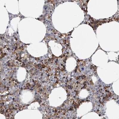 Immunohistochemistry-Paraffin: SEBOX Antibody [NBP2-14552]