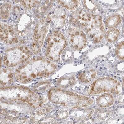 Immunohistochemistry-Paraffin: SEC11C Antibody [NBP1-80774]
