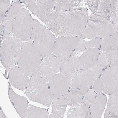 Immunohistochemistry-Paraffin: SEC11C Antibody [NBP1-80774]