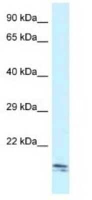 Western Blot: SEC11C Antibody [NBP1-79339]