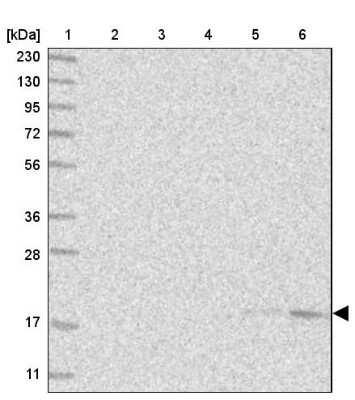 Western Blot: SEC11C Antibody [NBP1-80774]
