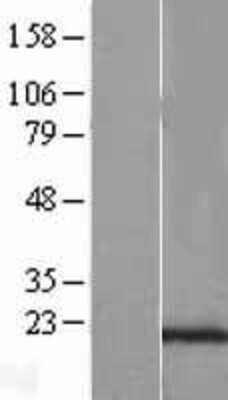 Western Blot: SEC11C Overexpression Lysate [NBL1-15773]