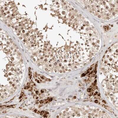 Immunohistochemistry: SEC14L1 Antibody [NBP2-38133]