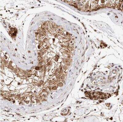 Immunohistochemistry-Paraffin: SEC14L1 Antibody [NBP1-80882]