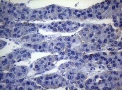 Immunohistochemistry: SEC14L1 Antibody (OTI3A6) - Azide and BSA Free [NBP2-74046]