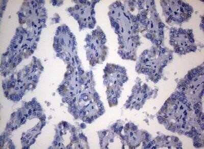 Immunohistochemistry: SEC14L1 Antibody (OTI3A6) - Azide and BSA Free [NBP2-74046]
