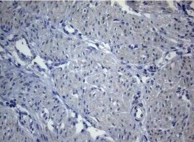 Immunohistochemistry: SEC14L1 Antibody (OTI3A6) - Azide and BSA Free [NBP2-74046]