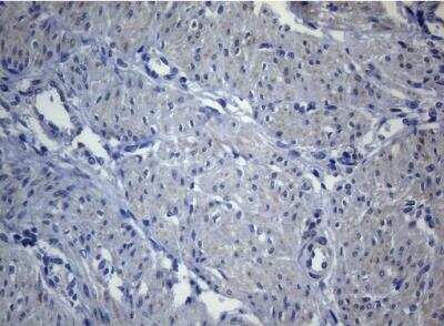Immunohistochemistry-Paraffin: SEC14L1 Antibody (OTI3A6) [NBP2-45729]
