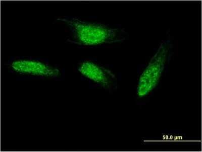 Immunocytochemistry/ Immunofluorescence: SEC14L2 Antibody (2E5) [H00023541-M05]