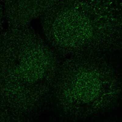 Immunocytochemistry/ Immunofluorescence: SEC14L2 Antibody [NBP2-39029]