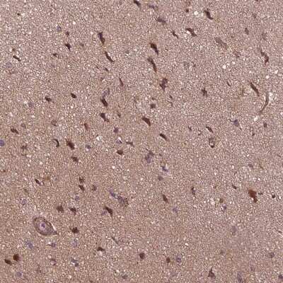 Immunohistochemistry-Paraffin: SEC14L2 Antibody [NBP2-39029]