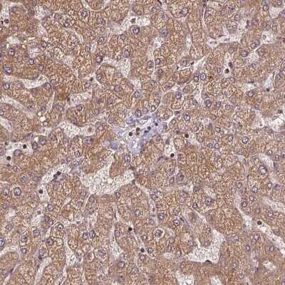 Immunohistochemistry-Paraffin: SEC14L2 Antibody [NBP2-39029]