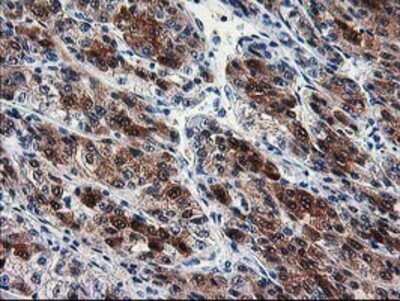 Immunohistochemistry: SEC14L2 Antibody (OTI4H2) - Azide and BSA Free [NBP2-74051]