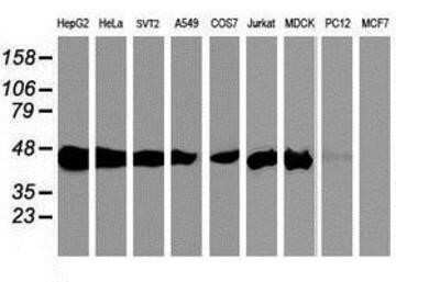 Western Blot: SEC14L2 Antibody (OTI4H2)Azide and BSA Free [NBP2-74051]
