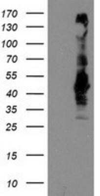 Western Blot: SEC14L2 Antibody (OTI4H2)Azide and BSA Free [NBP2-74051]