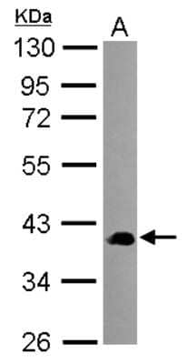 Western Blot: SEC14L2 Antibody [NBP2-15111]