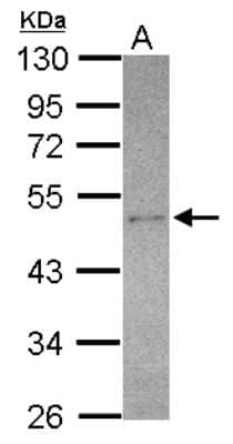 Western Blot: SEC14L2 Antibody [NBP2-15112]