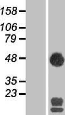 Western Blot: SEC14L2 Overexpression Lysate [NBP2-07443]