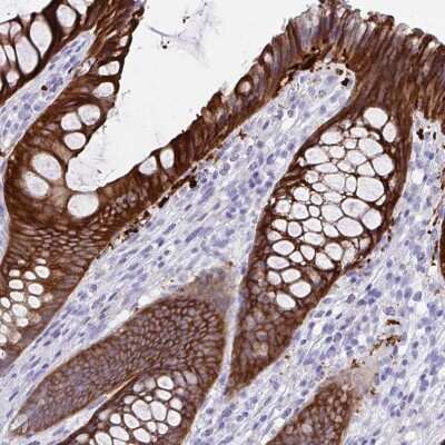 Immunohistochemistry: SEC14L3 Antibody [NBP2-31769]