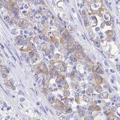 Immunohistochemistry: SEC14L3 Antibody [NBP2-31769]