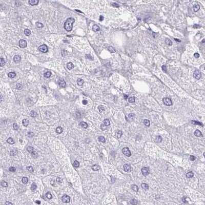 Immunohistochemistry: SEC14L3 Antibody [NBP2-31769]