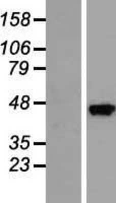 Western Blot: SEC14L3 Overexpression Lysate [NBP2-05087]