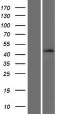 Western Blot: SEC14L4 Overexpression Lysate [NBP2-05088]