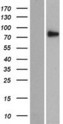 Western Blot: SEC14L5 Overexpression Lysate [NBP2-07293]