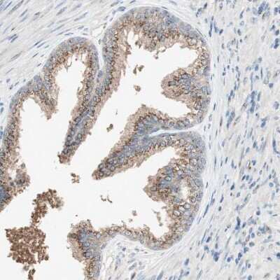Immunohistochemistry-Paraffin: SEC16A Antibody [NBP1-83016]