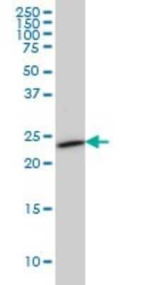 Western Blot: SEC22B Antibody (1E1) [H00009554-M01]