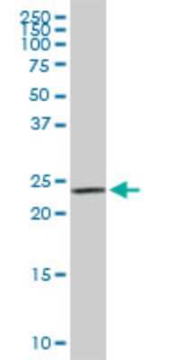 Western Blot: SEC22B Antibody (1E1) [H00009554-M01]