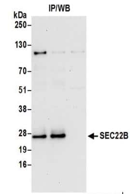 Immunoprecipitation: SEC22B Antibody [NBP2-37701]