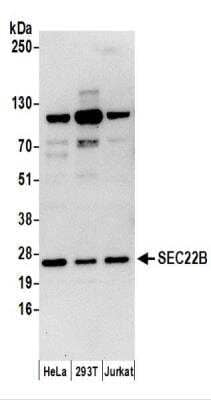 Western Blot: SEC22B Antibody [NBP2-37701]