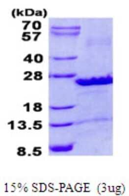 SDS-PAGE: Recombinant Human SEC22B His Protein [NBP2-23454]