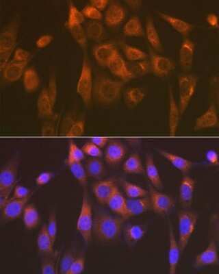 Immunocytochemistry/ Immunofluorescence: SEC23A Antibody (1D4R7) [NBP3-16667]