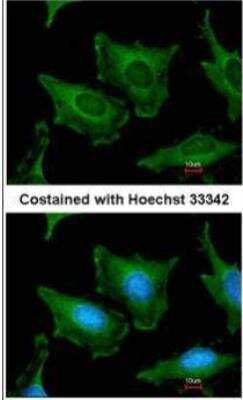 Immunocytochemistry/ Immunofluorescence: SEC23A Antibody [NBP1-32773]