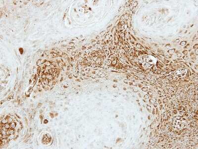 Immunohistochemistry-Paraffin: SEC23A Antibody [NBP1-32773]
