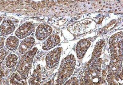 Immunohistochemistry-Paraffin: SEC23A Antibody [NBP1-32773]