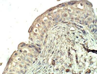 Immunohistochemistry-Paraffin: SEC23A Antibody [NBP3-12340]