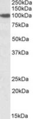 Western Blot: SEC23A Antibody [NBP1-47201]