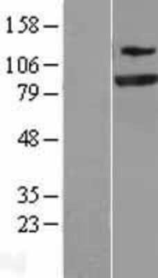 Western Blot: SEC23A Overexpression Lysate [NBL1-15777]